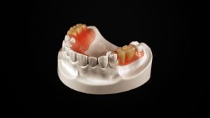 Mon Prothésiste - Laboratoire prothèse dentaire Paris - Qualité supérieure de prothèse dentaire céramique, stellite valplast, implant céramique, bio stellite, CAD CAM