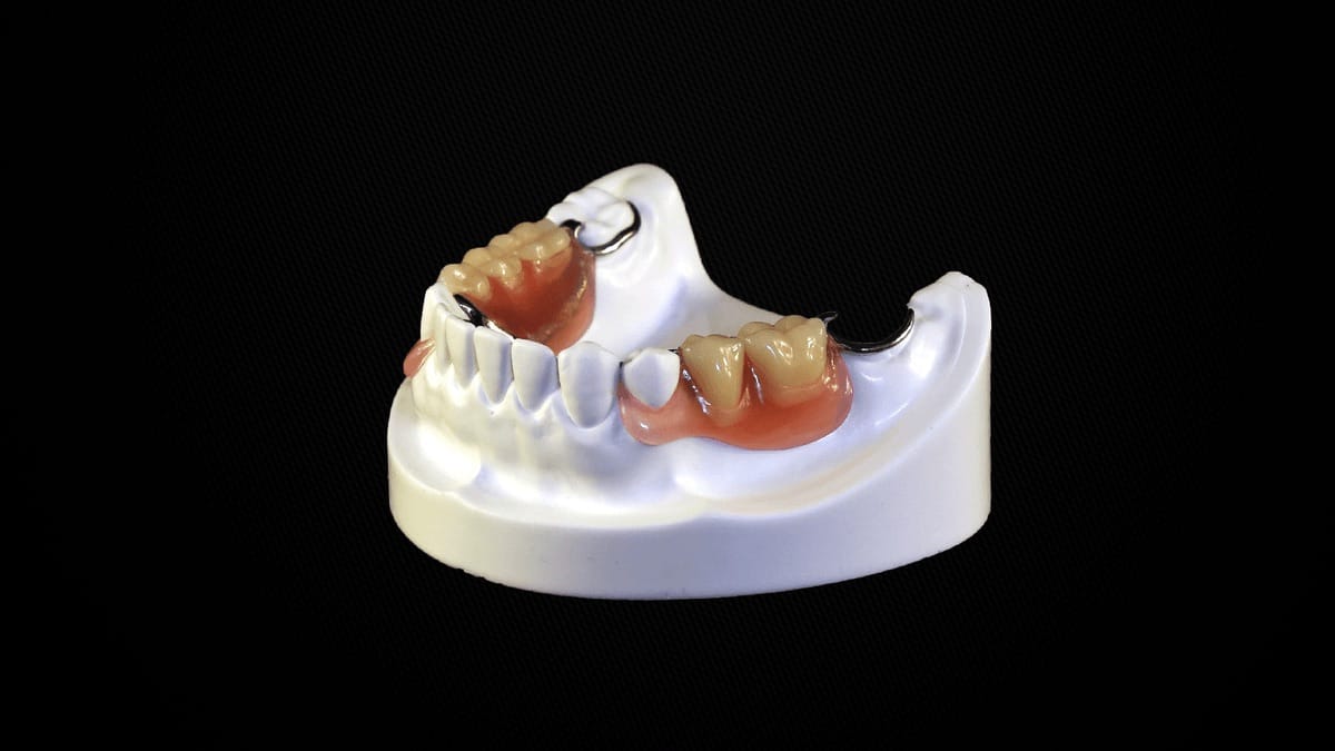 StelliteValplast® prothèse dentaire amovible