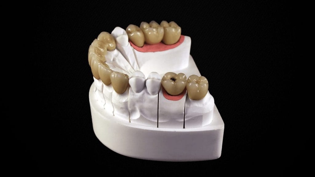 100pc Fausse couronne dentaire Résine Porcelaine Matériau Dents temporaires  Couronne Soins bucco-dentaires réalistes Blanchiment des dents Couronne  molaire antérieure